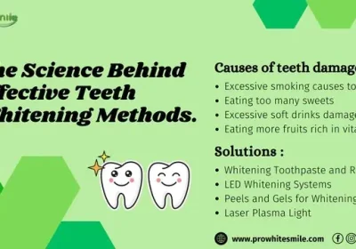 www.prowhitesmile.com_wp-content_uploads_2024_08_The-Science-Behind-Effective-Teeth-Whitening-Methods